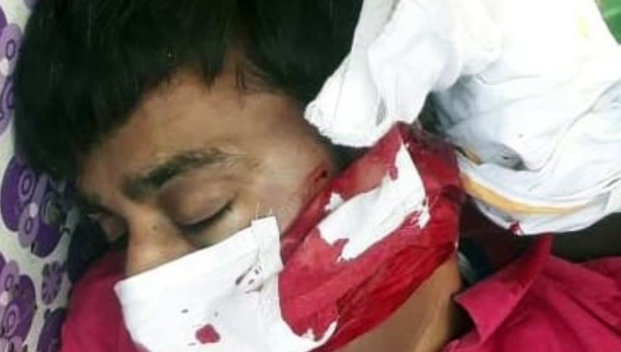 इटावा: हाइवे पर स्कूटी सवार युवक की सड़क दुर्घटना में हुई मौत