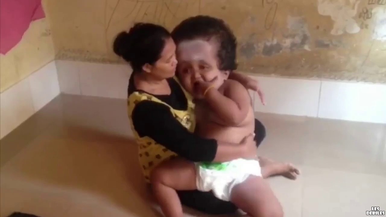 Probablement le plus grand bébé du monde