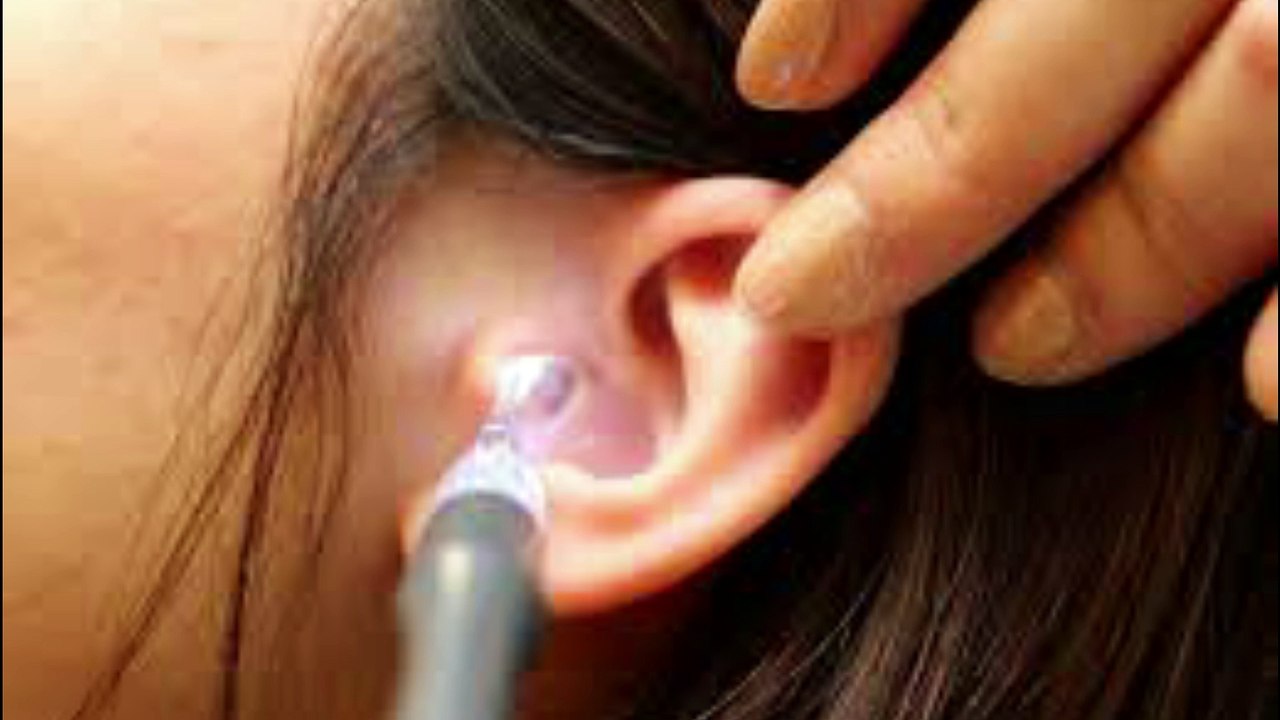 Clean of your ear||कान की साफ सफाई में लापरवाही||ऐसी गलतियाँ सपने में भी न करें||Doctor se mile