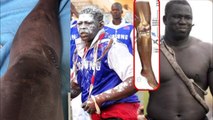 Opération du genou Ali Ndiaye interpelle les lutteurs, parle du cas de Yekini et conseille Lac Rose