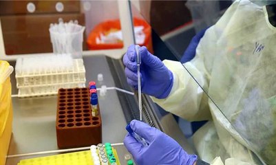 Covid-19: How do they perform Coronavirus test?