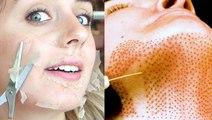 11 grossly satisfying beauty treatments that'll leave you with better skin