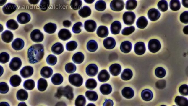 Kalcker da respuesta a las afirmaciones falsas