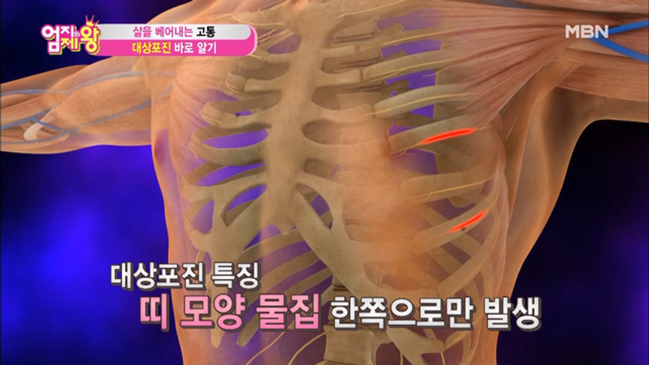 노년 건강 위협하는 3대 질환 두 번째! !