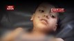 Madhya Pradesh: 8-year-old boy injured after falling from tree in Barwani