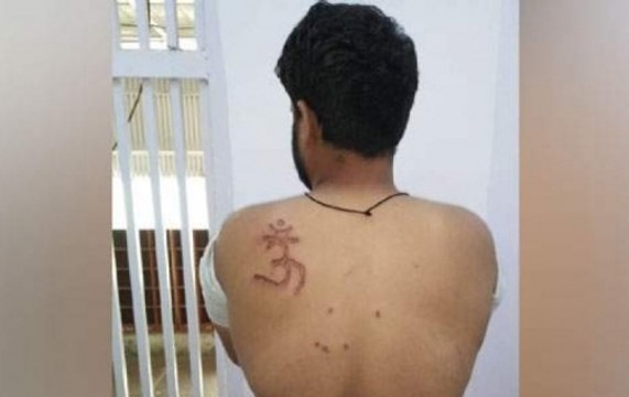 Not police, Tihar prisoner branded himself with ‘Om’ symbol