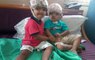 How AIIMS Doctors Conducted Surgery Of Conjoined Odisha Twins