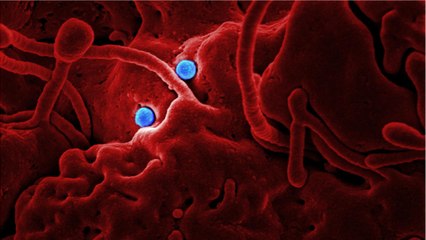 What Happened At A CDC Lab Delayed COVID-19 Tests For Two Months