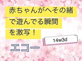 【ultrasonic diagnostics】baby play with umbilical cord☆pregnancy,fetus