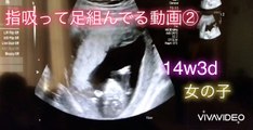 【ultrasonic diagnostics】A baby sucks her finger while crossing her legs ①☆pregnancy,fetus