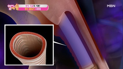 천식 치료의 기본!