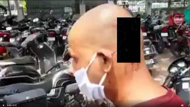 इंदौर में सर्वे करने गई मेडिकल टीम पर अब चाकू से हमला, बीच-बचाव करने आए युवक के लगा चाकू