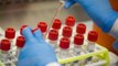 Vaccine to treat coronavirus soon? Oxford researchers promise remedy