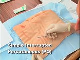 Suture Techniques for Skin Closure - DnbMentors.com