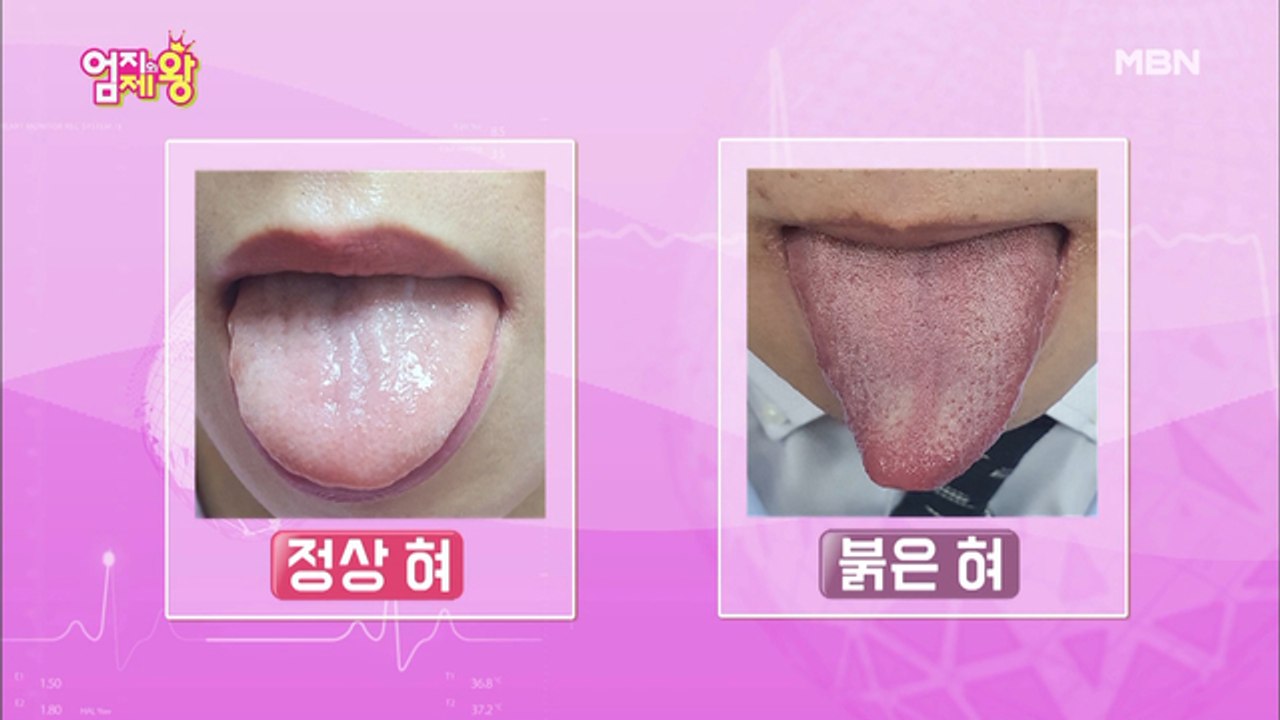 얼굴과 혀를 보면 뇌 독소가 보인다? 뇌 건강 [자가 진단법]