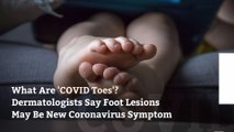 What Are 'COVID Toes'? Dermatologists Say Foot Lesions May Be New Coronavirus Symptom