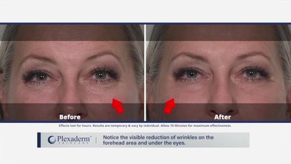 Is working from home aging you? Try Plexaderm