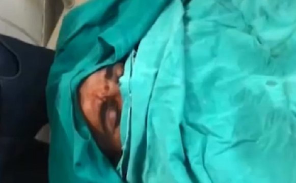 क्रिकेटर मोहम्मद शमी का हुआ एक्सिडेंट, सिर में आई चोटें