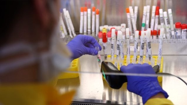 Dünya Sağlık Örgütü, koronavirüsün ilacı için paylaştığı raporu hatalı diye kaldırdı