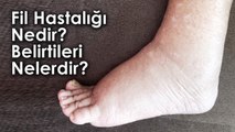 Fil Hastalığı Nedir ve Belirtileri Nelerdir?