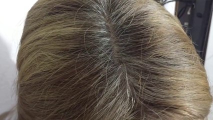 COMO ELIMINAR LAS CANAS NATURALMENTE CON REMEDIOS CASEROS _ AndyZarturno