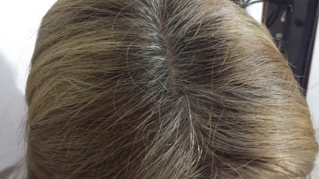 COMO ELIMINAR LAS CANAS NATURALMENTE CON REMEDIOS CASEROS _ AndyZarturno
