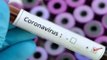 number of coronavirus positive cases in jodhpur reached 370