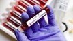 ICMR halts procurement of rapid antibody test kits from China