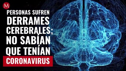Personas de entre 30 y 40 sufren derrames cerebrales; no sabían que tenían coronavirus