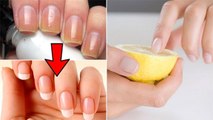 नाखूनों का पीलापन इन आसान तरीकों से करें दूर । Home remedies to get rid of yellow nails । Boldsky