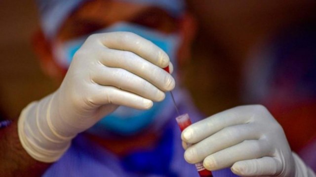 145% profiteering exposed in Covid-19 rapid test kits