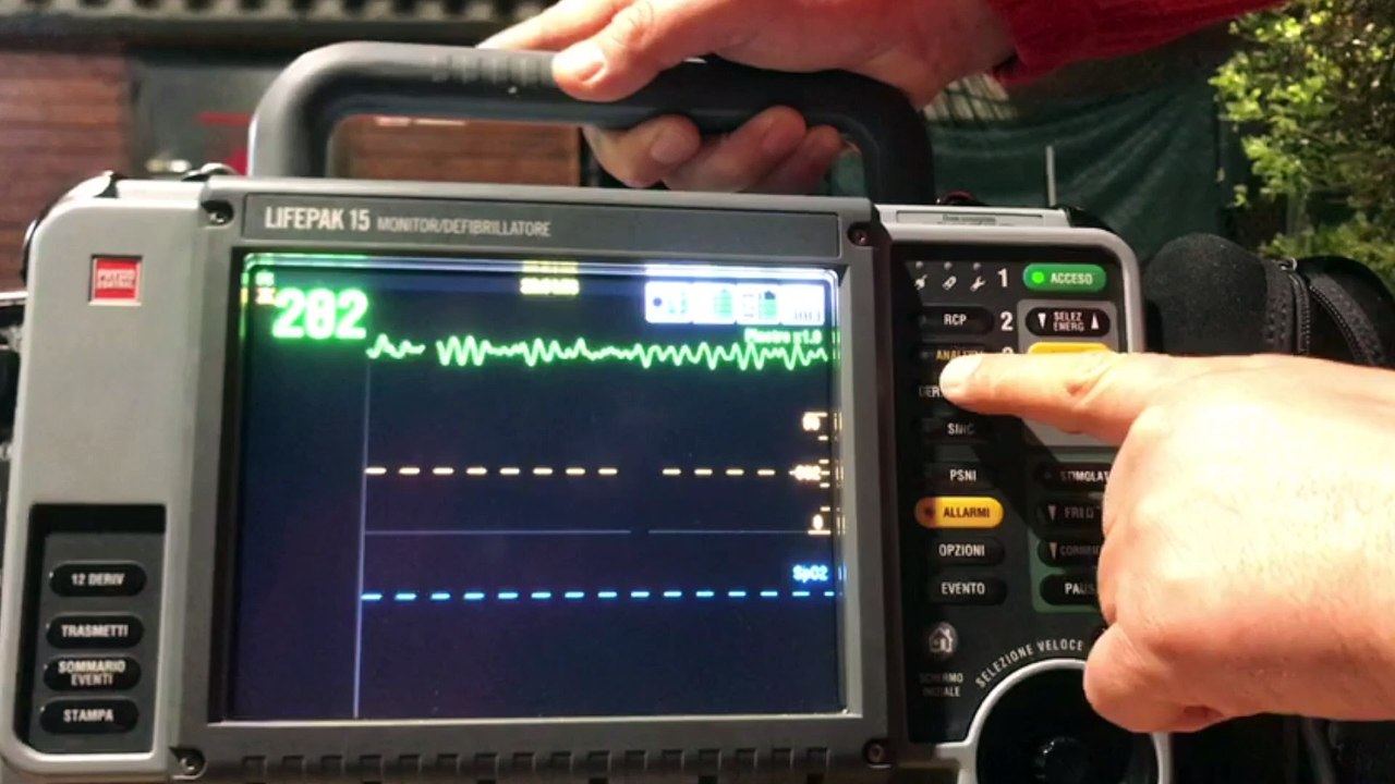 Defibrillazione Pediatrica