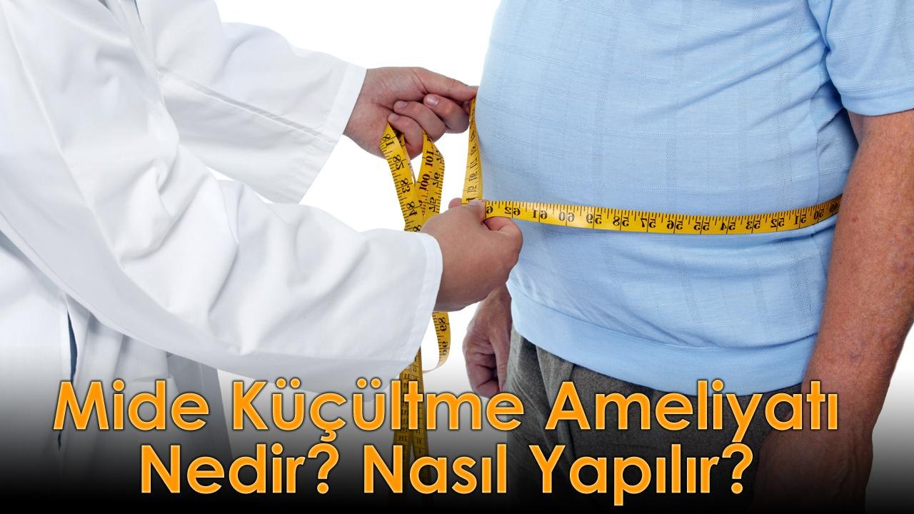 Mide Küçültme Ameliyatı Nedir ve Nasıl Yapılır?
