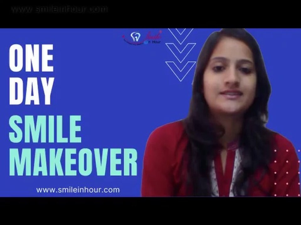 Instant Cosmetic Dental Veneers Review - One Visit Smile Makeover from Smile in Hour India