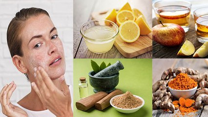 Skin पर भूलकर भी ना लगाएं ये 5 चीजें, जिंदगी भर पड़ेगा पछताना | Skin Care Tips | Boldsky