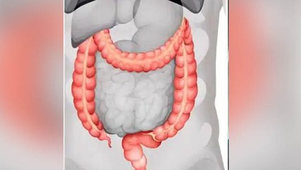 Colon Infection से बचने के लिए Diet में शामिल करें ये Foods,जानें इसके गुण । Boldsky