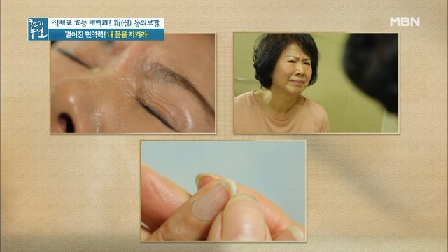 ※집중!※ 면역력 저하 시 나타나는 신호들! [눈곱, 손톱, 백태와 입 냄새]