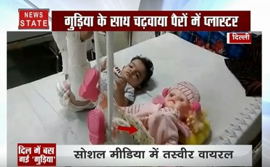 अस्पताल में दिखा अनोखा बंधन, गुड़िया के साथ प्लास्टर चढ़ाए हुए बच्ची का Video Viral