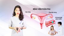 Phòng khám Đa Khoa 52 Nguyễn Trãi giới thiệu về viêm phần phụ