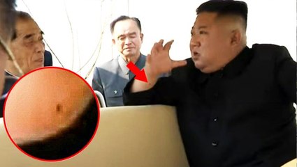 Haftalar sonra ortaya çıkan Kim'in, bileğindeki yara detayı dikkat çekti: Kalp ameliyatı olmuş olabilir