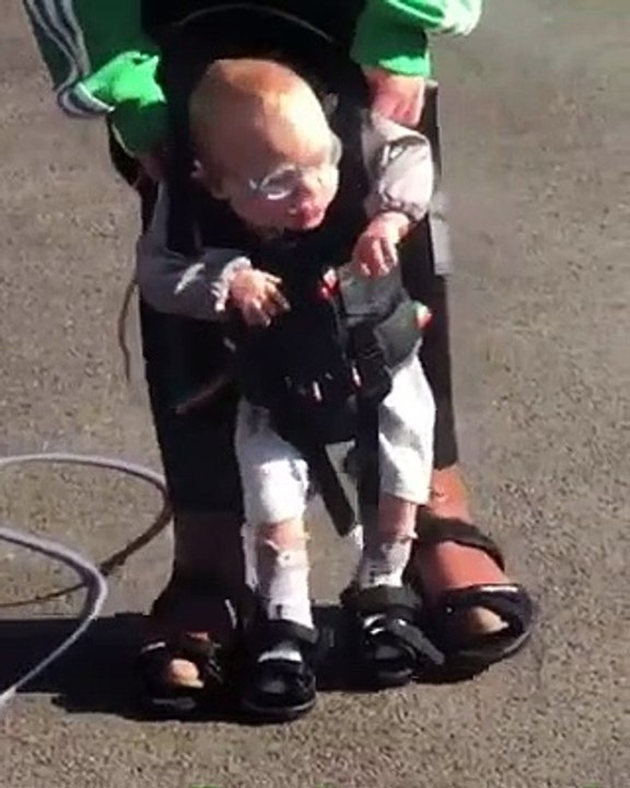 Worksop miracle baby George Bownes walks 100 metres a day for Bassetlaw Hospital