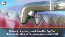 GÓC CẢNH GIÁC: Cô gái trẻ rơi cả hàm răng sau khi bọc răng sứ (07.11.2018)