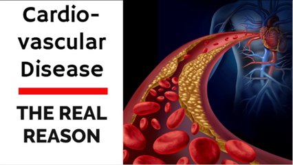 The Real Reason Why Meat Leads to Cardiovascular Disease