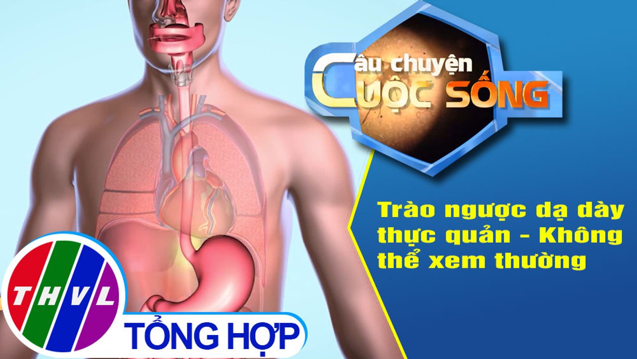 Trào ngược dạ dày thực quản - Không thể xem thường