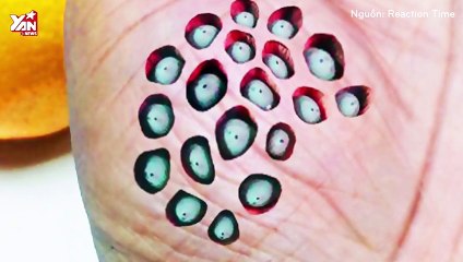 Giải Mã Nỗi Sợ: Sợ Lỗ