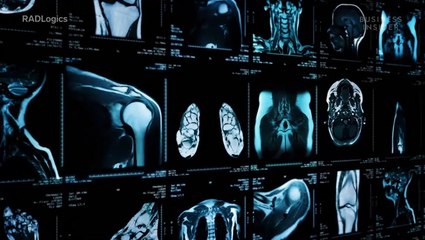 Apple, Google, 23andMe, and others are fighting COVID-19, from wearables to faster CT scans to contact tracing