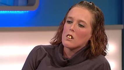 Traumatisée à cause de ses dents, une émission de TV lui sauve la vie