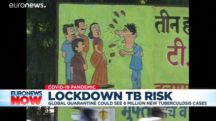 Millions at risk of tuberculosis amid COVID-19 lockdowns, warns study