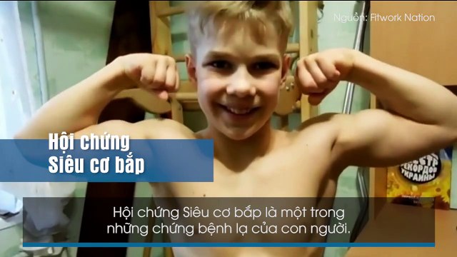 Điểm danh 6 hội chứng kì lạ mà đảm bảo nghe xong ai cũng thích... mắc phải