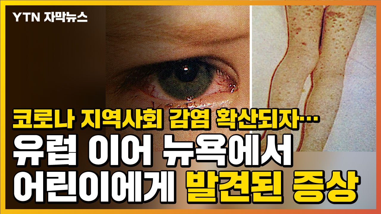 [자막뉴스] 지역사회 감염 확산되자...어린이에게 발견된 '공통 증상' / YTN